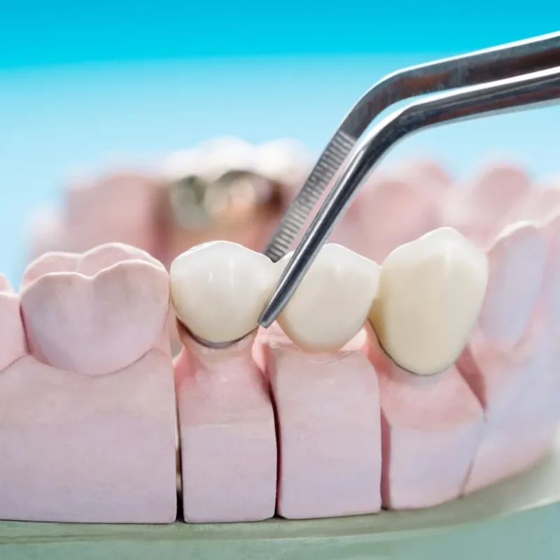 Diyarbakır Protez Diş Fiyatları